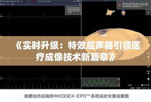 《实时升级：特效超声器引领医疗成像技术新篇章》