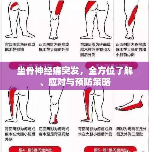 坐骨神经痛突发,全方位了解、应对与预防策略