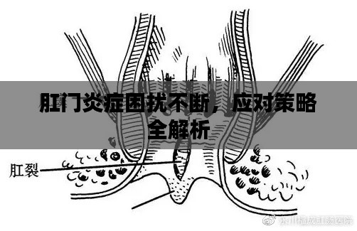 肛门炎症困扰不断,应对策略全解析