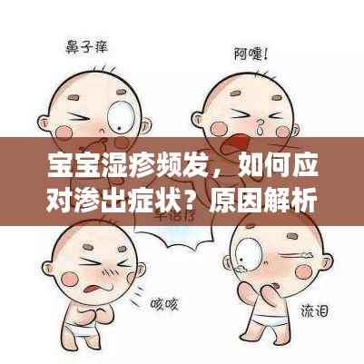 宝宝湿疹频发，如何应对渗出症状？原因解析与预防策略全攻略