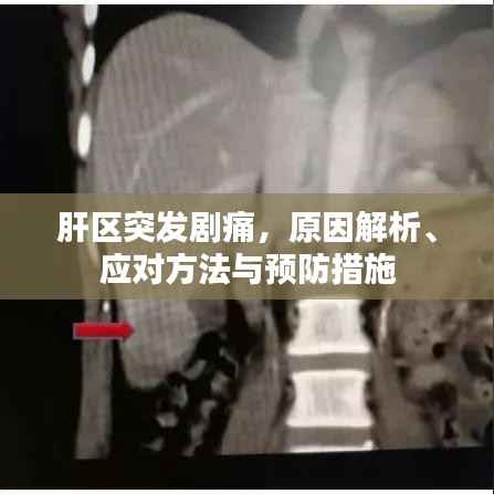 肝区突发剧痛，原因解析、应对方法与预防措施
