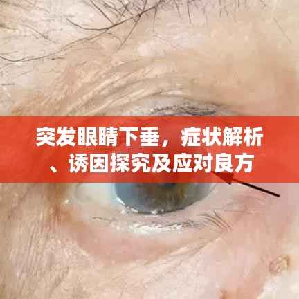 突发眼睛下垂，症状解析、诱因探究及应对良方