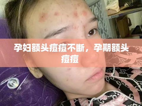 孕妇额头痘痘不断,孕期额头痘痘