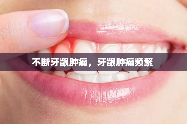 不断牙龈肿痛，牙龈肿痛频繁 