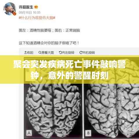 聚会突发疾病死亡事件敲响警钟,意外的警醒时刻