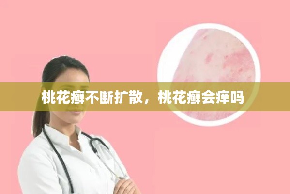 桃花癣不断扩散，桃花癣会痒吗 