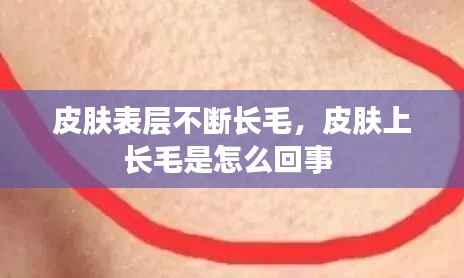 皮肤表层不断长毛，皮肤上长毛是怎么回事 