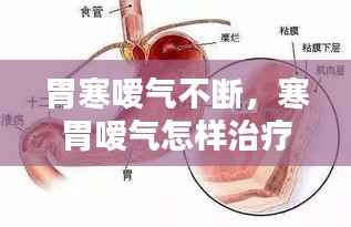胃寒嗳气不断，寒胃嗳气怎样治疗 