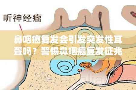 鼻咽癌复发会引发突发性耳聋吗？警惕鼻咽癌复发征兆！