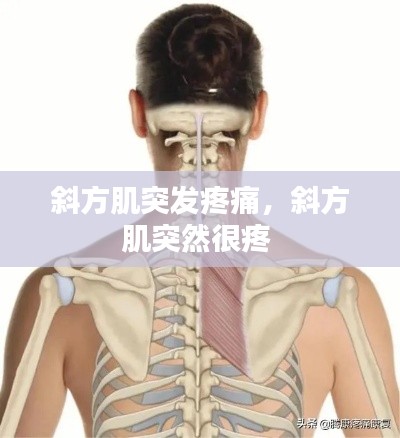 斜方肌突发疼痛,斜方肌突然很疼