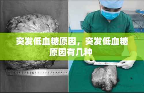 突发低血糖原因，突发低血糖原因有几种 