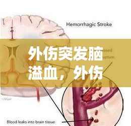 外伤突发脑溢血，外伤导致脑出血多久能恢复意识 