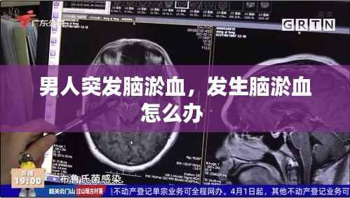 男人突发脑淤血，发生脑淤血怎么办 