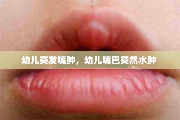 幼儿突发嘴肿，幼儿嘴巴突然水肿 