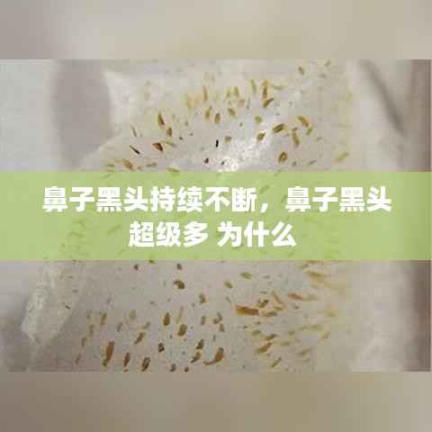 鼻子黑头持续不断，鼻子黑头超级多 为什么 