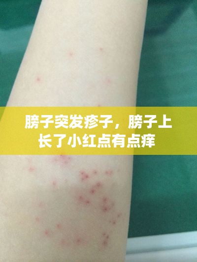 膀子突发疹子，膀子上长了小红点有点痒 