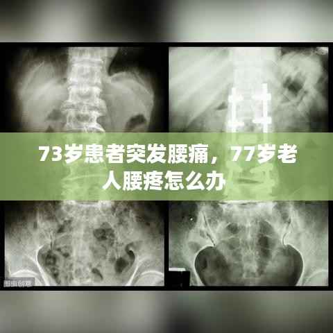 73岁患者突发腰痛，77岁老人腰疼怎么办 