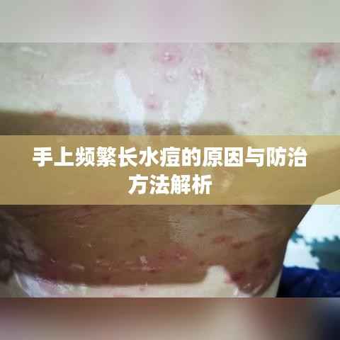 手上频繁长水痘的原因与防治方法解析