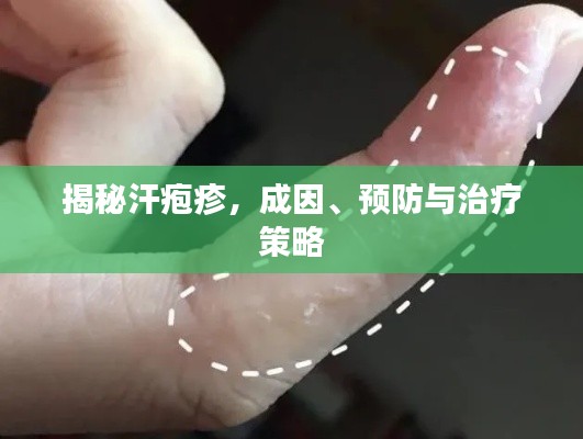 揭秘汗疱疹，成因、预防与治疗策略
