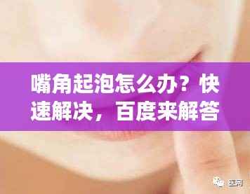 嘴角起泡怎么办？快速解决，百度来解答！