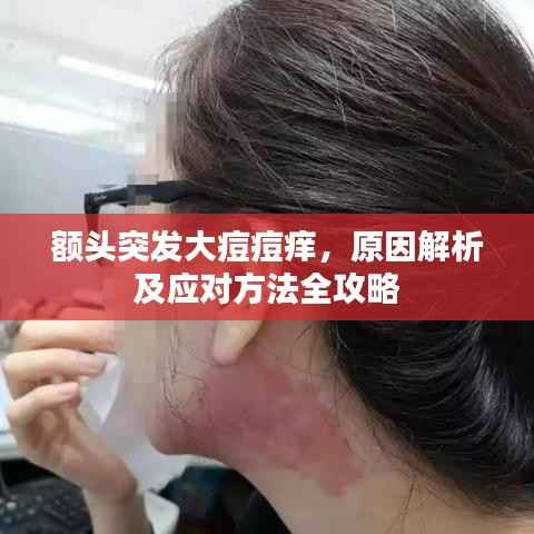 额头突发大痘痘痒，原因解析及应对方法全攻略