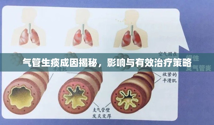 气管生痰成因揭秘，影响与有效治疗策略