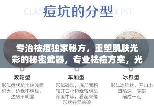 专治祛痘独家秘方，重塑肌肤光彩的秘密武器，专业祛痘方案，光彩照人不再是梦！