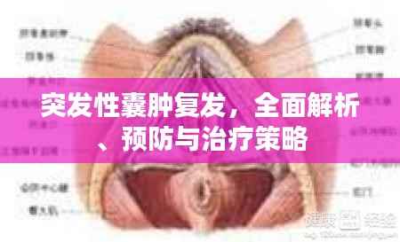 突发性囊肿复发,全面解析、预防与治疗策略
