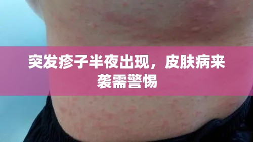 突发疹子半夜出现，皮肤病来袭需警惕