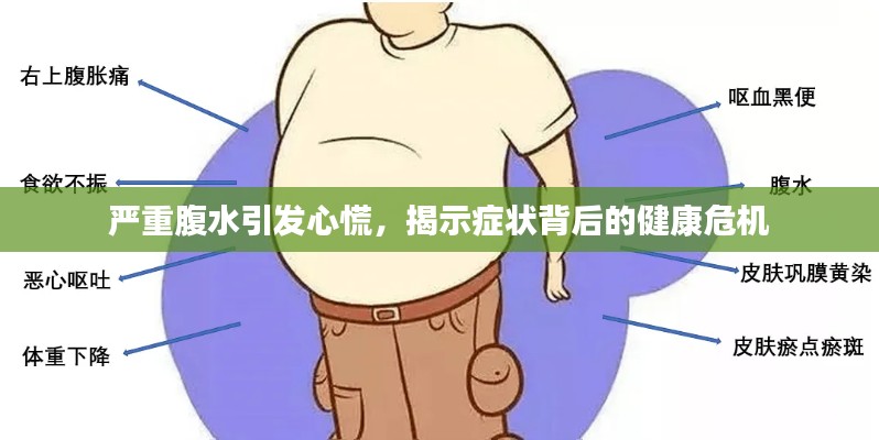严重腹水引发心慌，揭示症状背后的健康危机