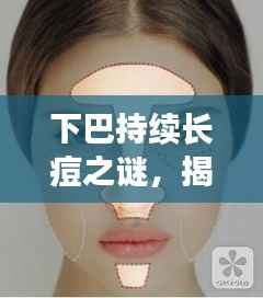 下巴持续长痘之谜，揭秘36岁人群的挑战与应对之道